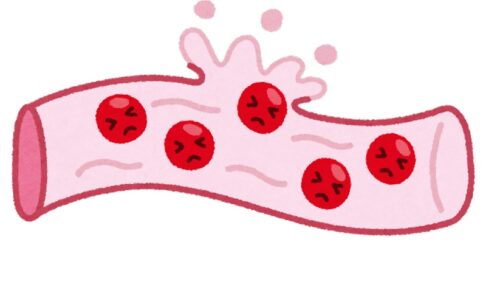 出血と不正出血 医知場 いちば