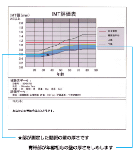 IMT_graph